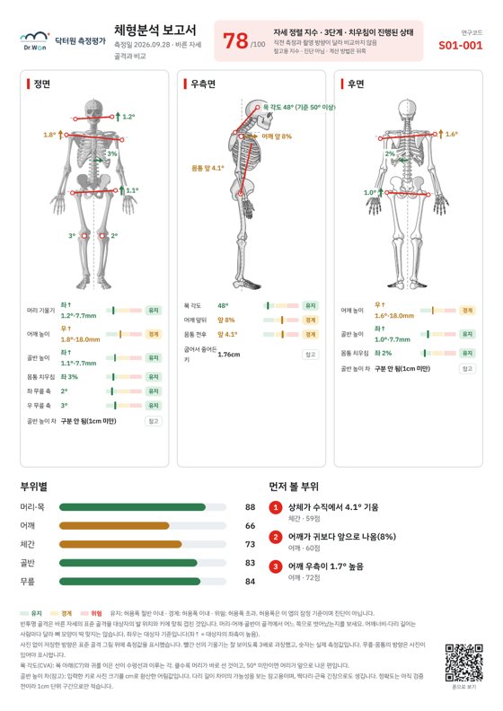 체형분석 보고서 — 바른 자세 골격과 비교한 지표·점수